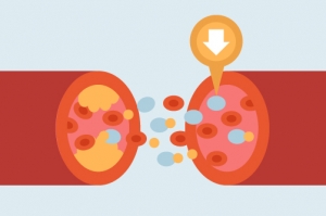 DS-XXXX COM HPF Cholesterol Combination-02