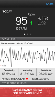A screenshot of the Cardiio Rhythm app. (Courtesy of Ming-Zher Poh) A screenshot of the Cardiio Rhythm app. (Courtesy of Ming-Zher Poh)