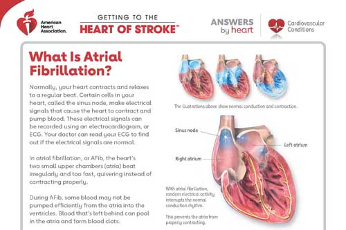 What is AFib sheet