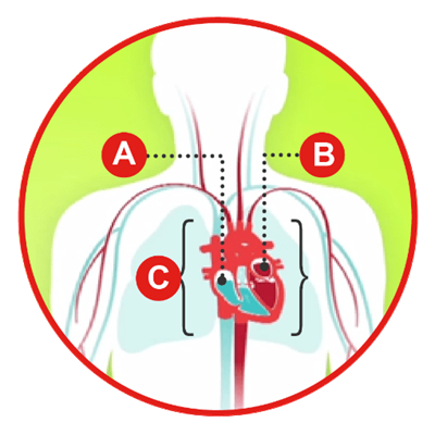 Types of heart failure diagram