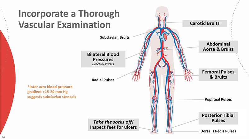 Clinical Assessment of PAD on the Primary Care Spectrum