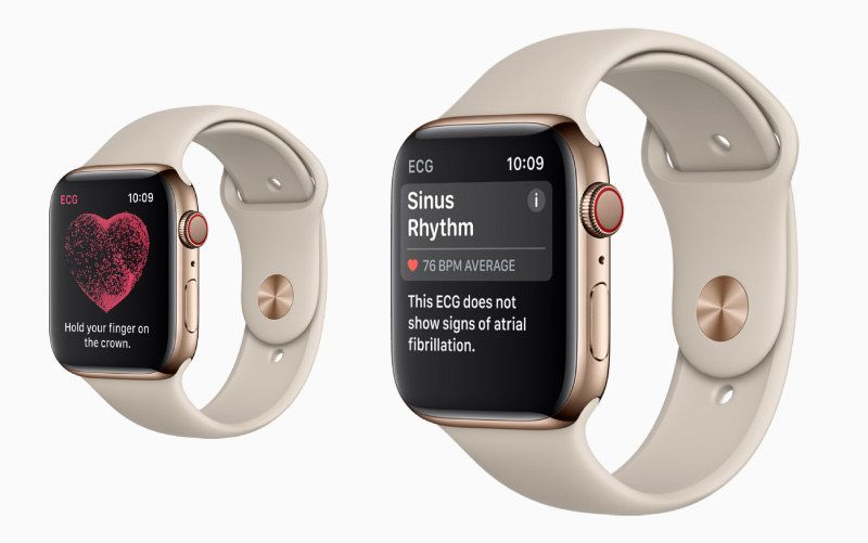 New Apple Watch can do an ECG