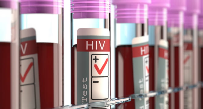 Test tube with HIV positive label