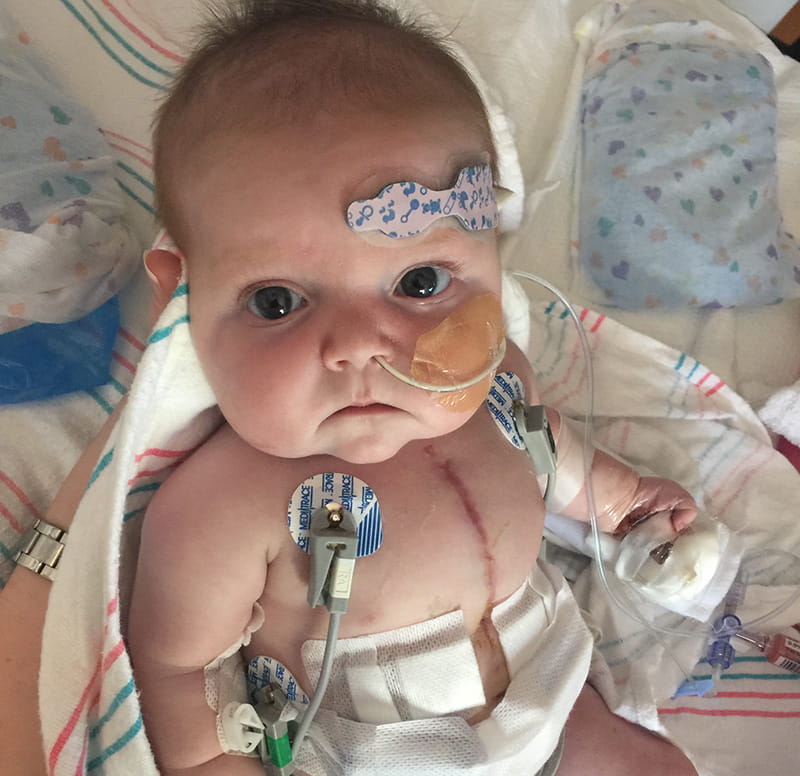 Halle was just 3 days old when she had her first heart surgery, followed by another at 4 months old. (Photo courtesy of Autumn Spivey)