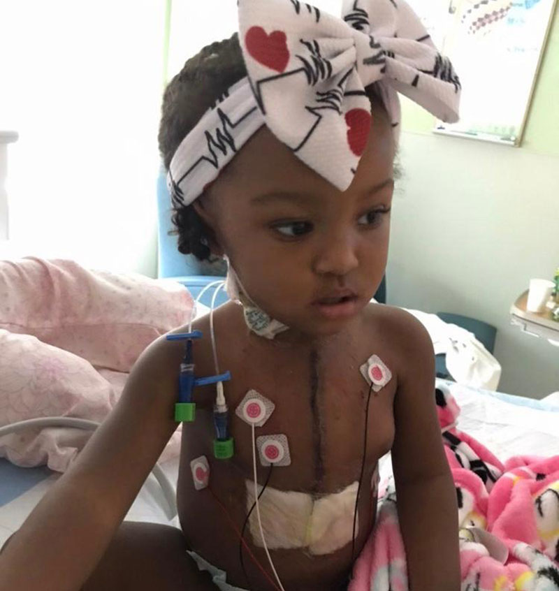 Bella Wilborne after her third open-heart surgery in February 2020. (Photo courtesy of Latisha Wilborne)