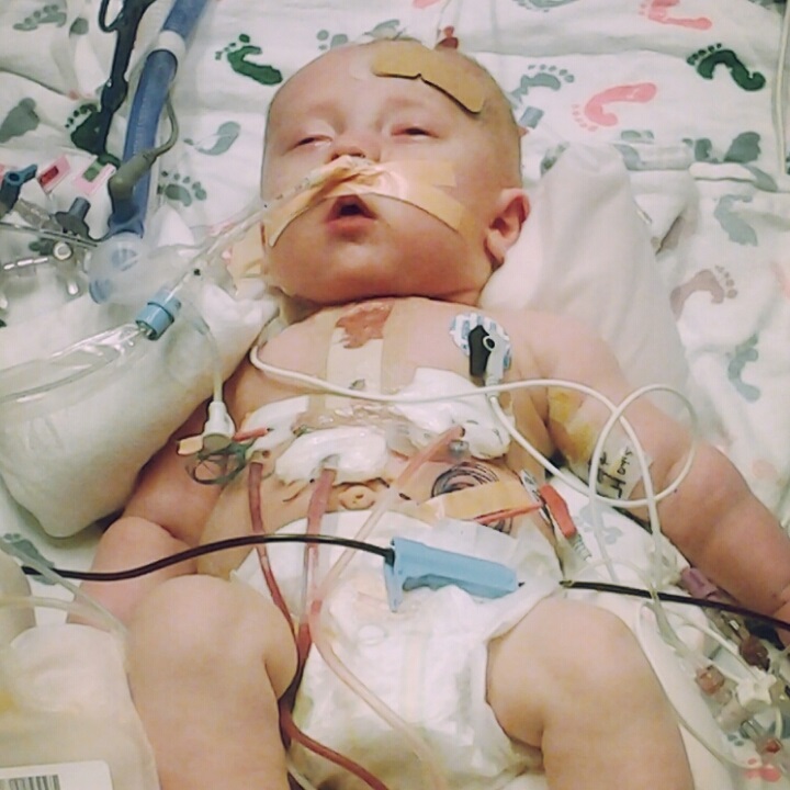 Kaden Livesay, post-surgery. At six months old, he had surgery to repair a leaky heart valve. (Photo courtesy of the Livesay family)