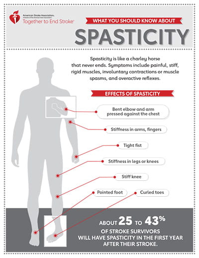 icd 10 code for spasticity as sequelae of stroke