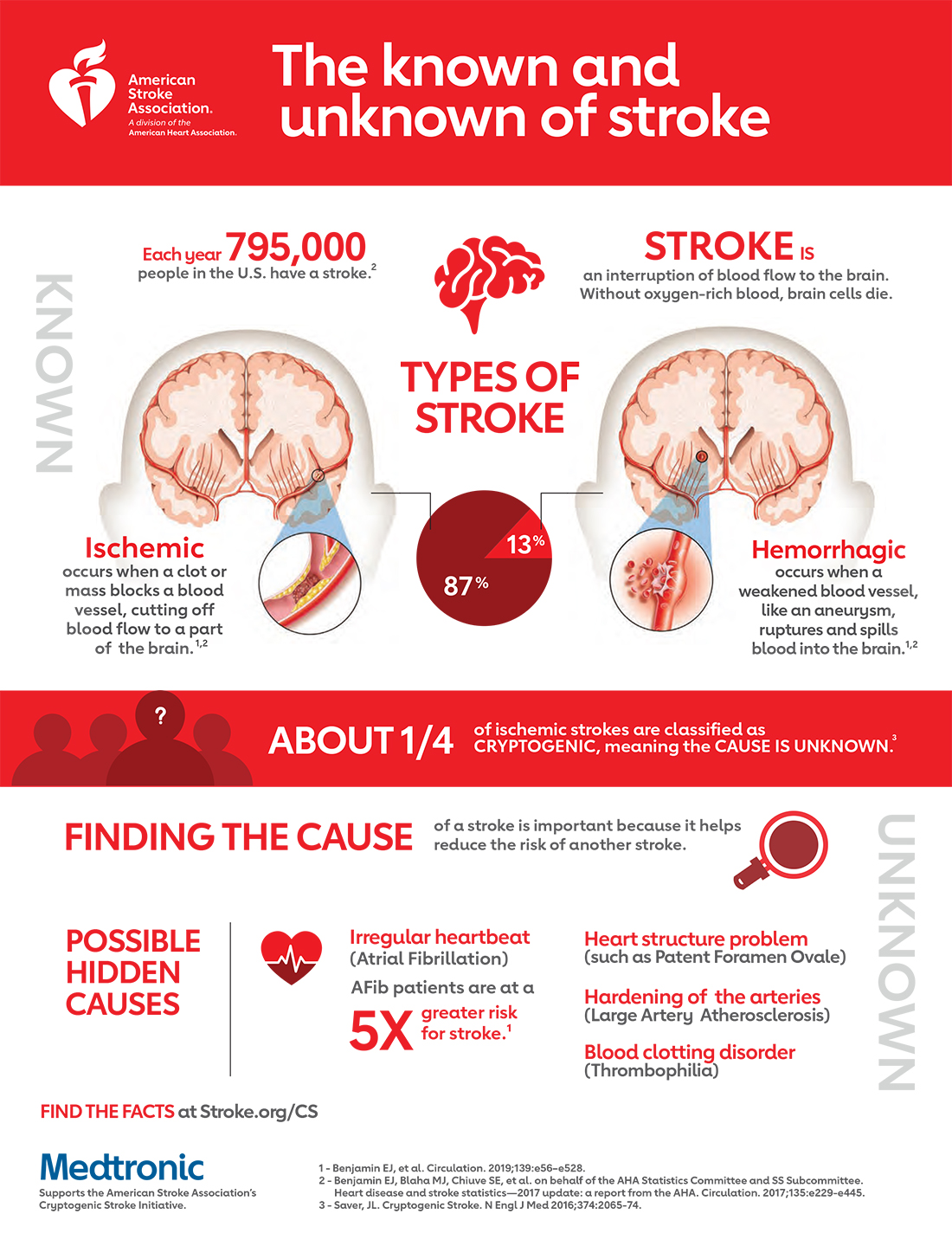 The Known and Unknown of Stroke Infographic