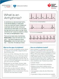 What is arrhythmia sheet