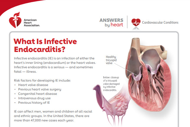 Infective Endocarditis | American Stroke Association