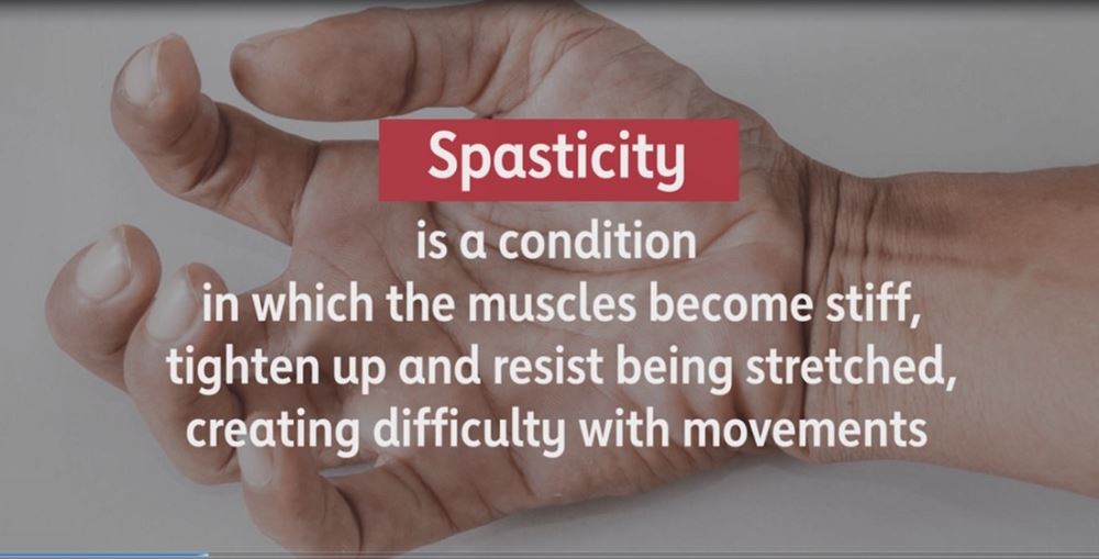 spasticity video statistic