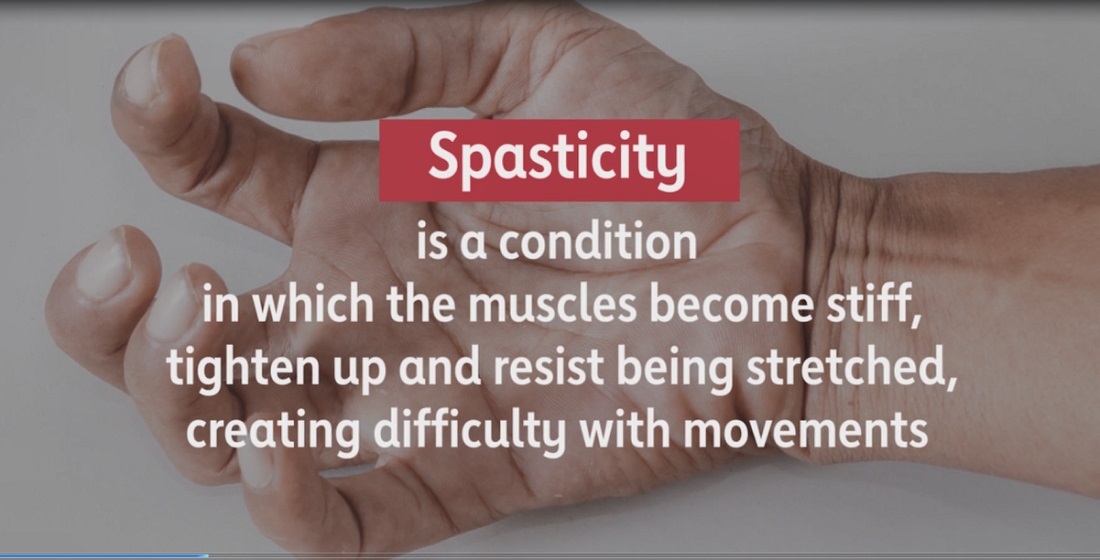 Spacicity Problem Spasticity | American Stroke Association